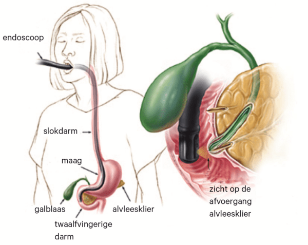 endoscopie