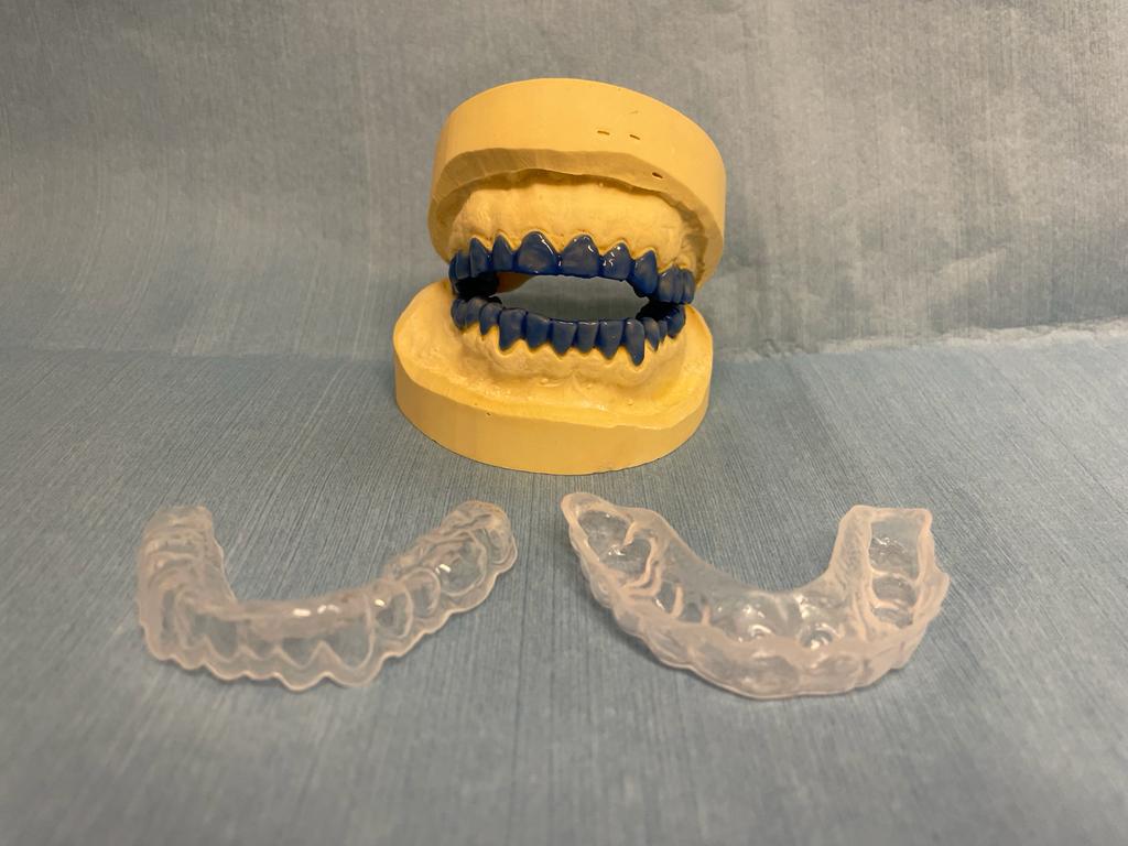 fluoridekappen