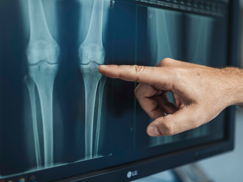 Beeldvorming knie orthopedie