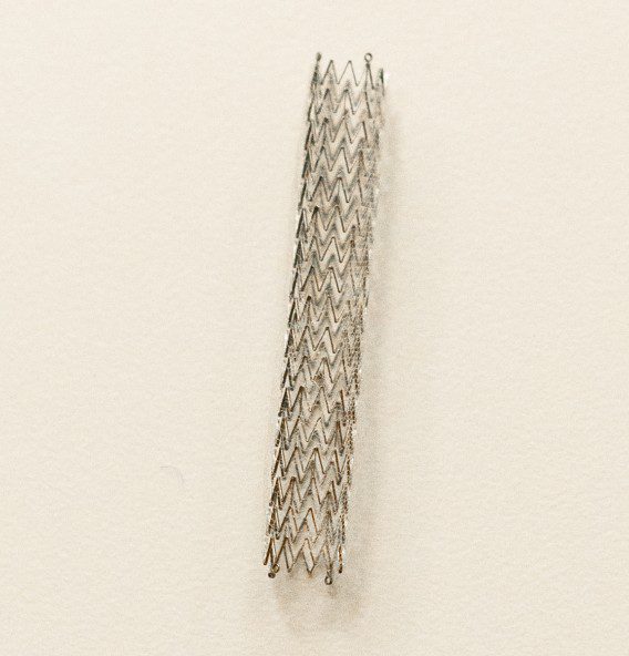 stent.jpg