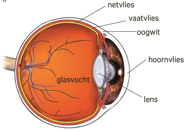 uveitis.png