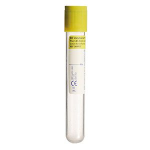 Urinebuis met boorzuur (alleen voor microbiologie)