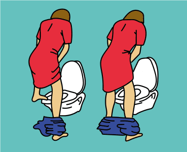 Zelfkatherisatie vrouw in verschillende houdingen: op de wc - figuur 2