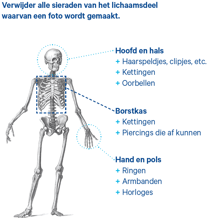 Verwijder alle sieraden van het lichaamsdeel waarvan een foto wordt gemaakt