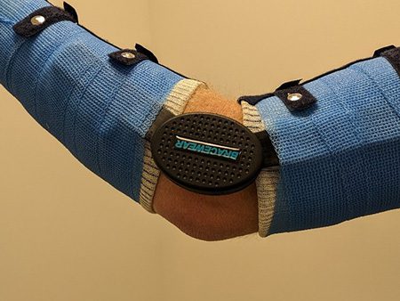 Elleboog brace scharnier ter hoogte van de elleboogsplooi 