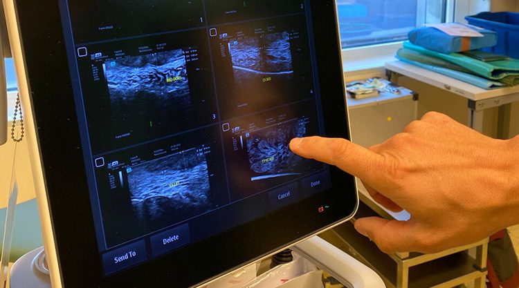 Onderzoek met medische gegevens
