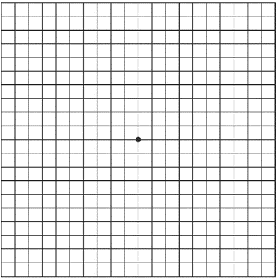 Amslertest