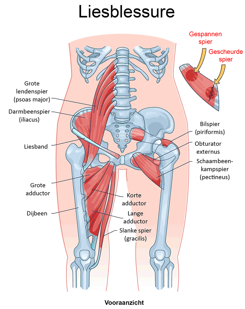 Liesblessure