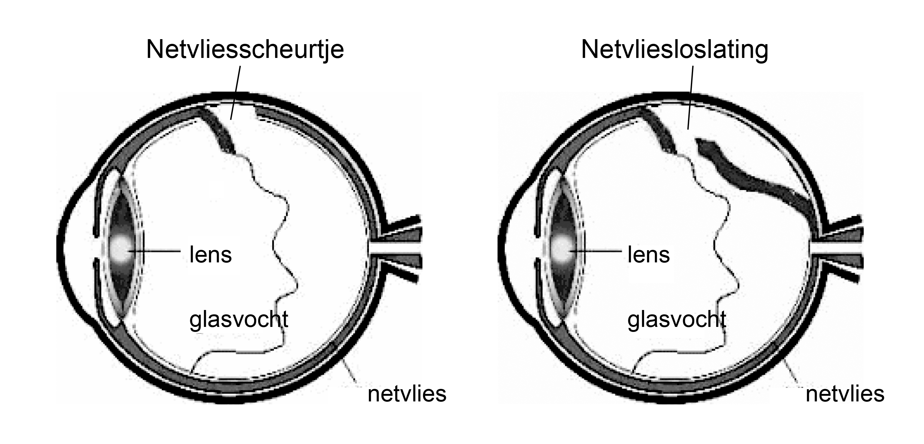 Vlekken en flitsen zien | HMC